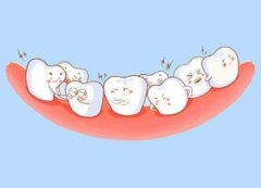 青上矫正齿科：儿童牙齿矫正，这三个黄金时期千万不要错过！